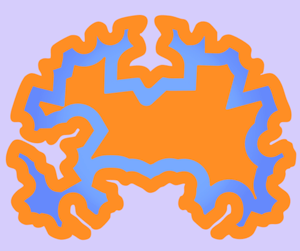 How to build neurodiversity support at work: The BNP Paribas blueprint